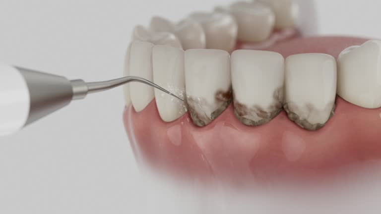 Trusted Teeth Cleaning And Checkup service in Edmonton, KY - Dentist Open Now